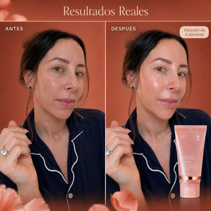 Mascarilla Reversa de Myetra